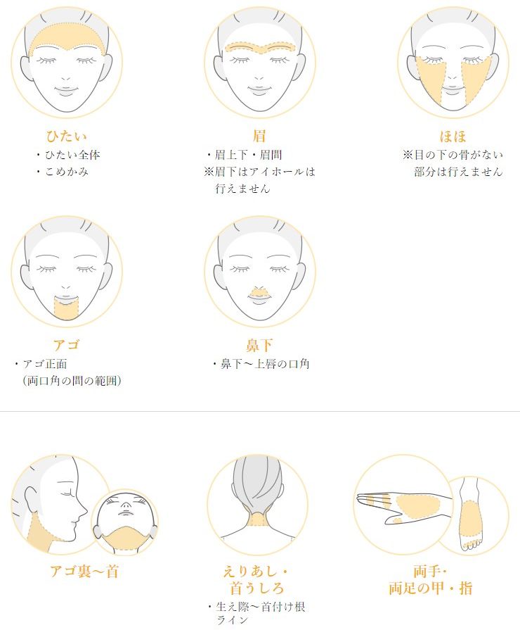 TBCのデリケートゾーンの脱毛部位