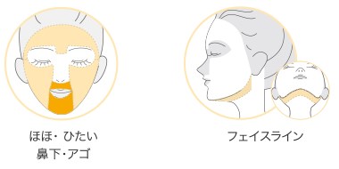 TBCの顔脱毛体験の照射範囲